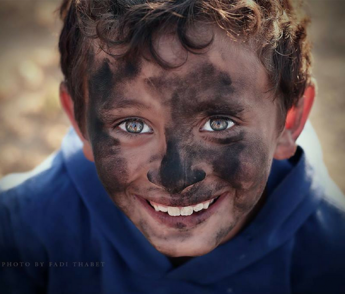 kondisi anak-anak gaza